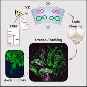 Electrokinetic mobility cerebellum bubbles